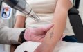 Illegal Beauty Treatments Shut Down: Rogue Esthetician Performed Risky Laser and Dental Procedures
