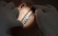 Morocco's Dental Tourism Boom: Luxury Smiles at a Fraction of European Prices