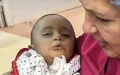 Scottish Billionaire Joins Operation Smile to Aid Moroccan Children with Cleft Palates