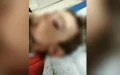 Toddler Mauled by Giant Rat in Neglected Housing Complex