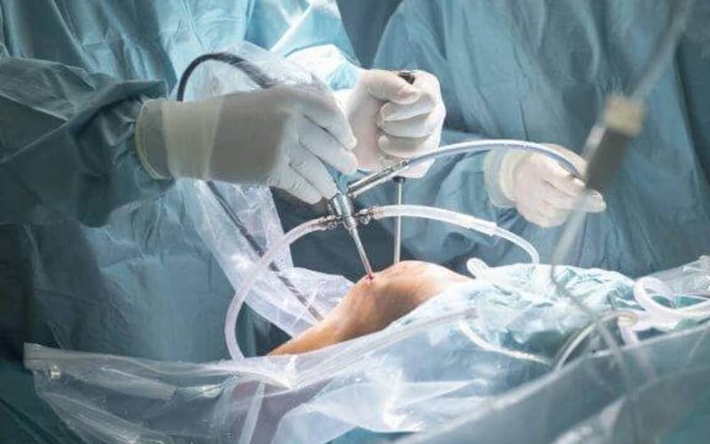 Groundbreaking Arthroscopic Knee Surgery Performed in Morocco's Rhamna Province
