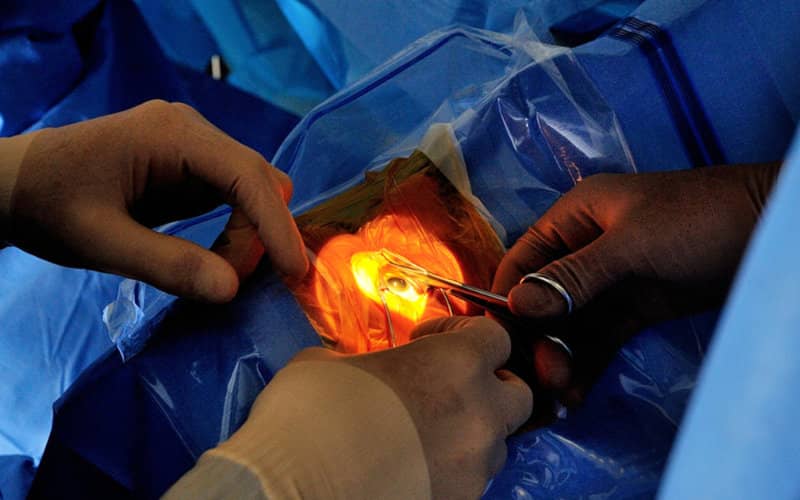 Moroccan Man Loses Sight After Surgery by Fake Doctor in Rabat Hospital