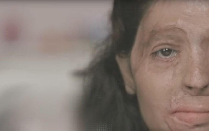 Moroccan Police Refute Viral Claims of Acid Attacks on Women