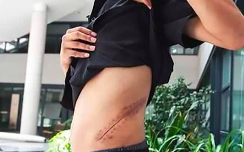 Turkish Organ Trafficking Ring Targets Desperate Moroccan Youth for Kidney Sales