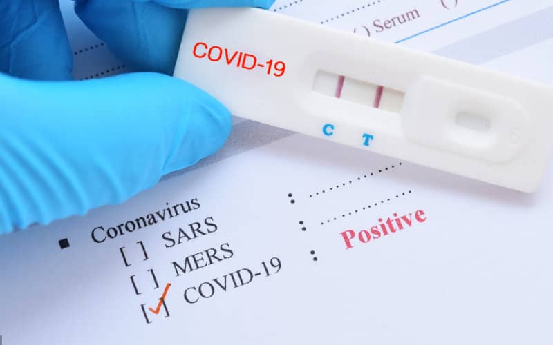 Morocco Considers Allowing Rapid COVID-19 Tests in Pharmacies