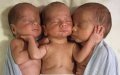 Rare Triplet Birth in Morocco: Three Babies Share Single Placenta