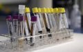 Morocco's Health Minister Declares COVID-19 Vaccine Trials Successful