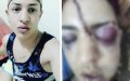 Moroccan Man Visiting from Spain Suffers Brutal Homophobic Attack in Kenitra