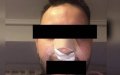 Moroccan Man Alleges Racist Attack by Spanish Nightclub Security, Sparking Investigation