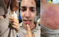 Moroccan Immigrant Alleges Racist Attack by Spanish Security Guards