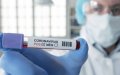 Casablanca Restricts COVID-19 Testing: Private Labs Now Limited to Travelers