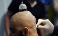 Controversial Islamic Healing Practices Raise Concerns in France, Study Finds
