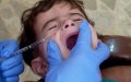 Leishmaniasis Outbreak Spreads to New Moroccan Provinces, Alarming Parents and Officials