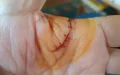 Exploding Wine Bottle: Carrefour Refuses Compensation to Injured Customer