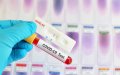 Fake COVID-19 Test Scam Targets Moroccan Expats in Spain