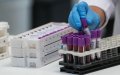 French Study: Rheumatoid Arthritis Drug Shows Promise in Treating Severe COVID-19