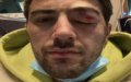 Moroccan Actor Hospitalized After Violent Assault by Gang in Paris Metro