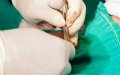 Moroccan Doctor Fined $1 Million for Botched Circumcision, Child Left Disabled