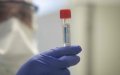 Moroccan-Italian Woman Evades COVID-19 Test After Showing Symptoms in Morocco