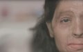 Moroccan Police Refute Viral Claims of Acid Attacks on Women