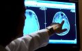 Moroccan Scientist Pioneers Groundbreaking Cancer Treatment Using Modified Viruses