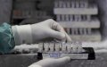 Moroccan Scientists Analyze Global COVID-19 Genomes in National Research Project