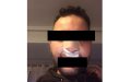 Moroccan Victim Seeks Justice After Brutal Racist Attack at Valencia Nightclub
