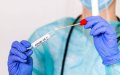 Morocco Launches Domestic Production of COVID-19 Tests, Aims for 2 Million Units Monthly