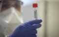 Morocco Secures 110,000 Coronavirus Test Kits from South Korean Firm