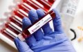 Morocco's Health Minister Defends COVID-19 Testing Accuracy Amid Concerns