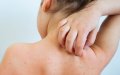 New Measles Variant from Morocco Detected in Brussels Wastewater