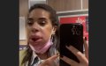 Reality TV Star Marwa Merazka Faces Health Scare After Lip Filler Removal Procedure