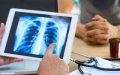 Study: Lung Cancer to Remain Top Cancer Killer in North Africa Through 2040