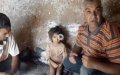 Viral Video Prompts Morocco's Health Ministry to Cover 8-Year-Old's Medical Costs