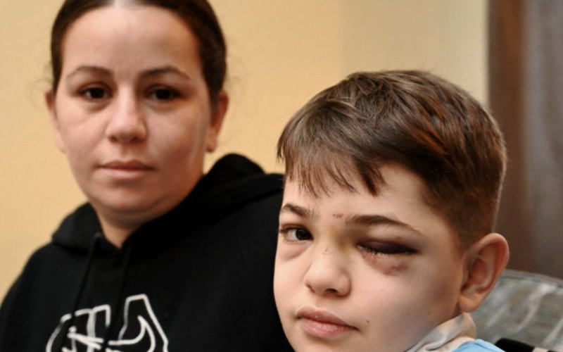 12-Year-Old with Epilepsy Faces Relentless Bullying, Parents Consider Homeschooling