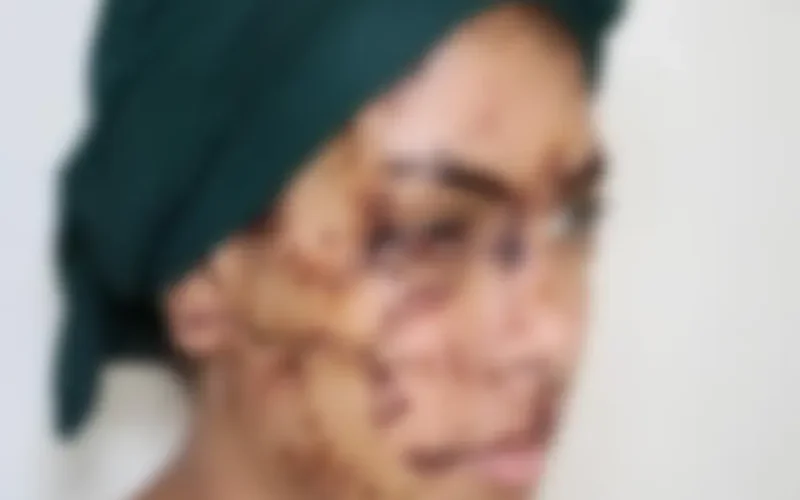 Affaire Imane à Taza: 15 years in prison for the ex-husband who had disfigured his wife