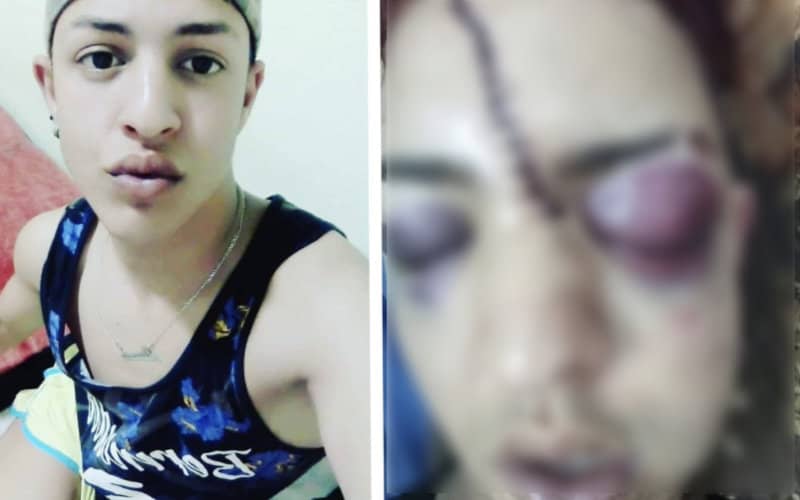 Moroccan Man Visiting from Spain Suffers Brutal Homophobic Attack in Kenitra