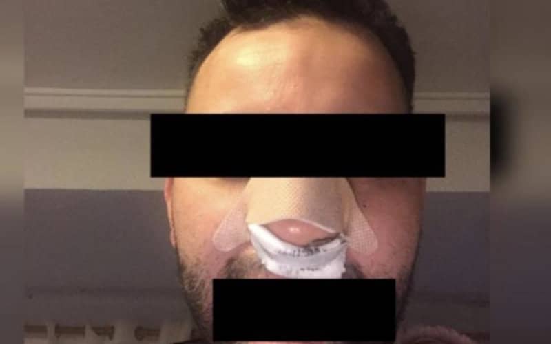 Moroccan Man Alleges Racist Attack by Spanish Nightclub Security, Sparking Investigation
