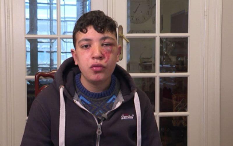 Brussels Police Probe Alleged Brutality After Anti-Racism Protest Arrest