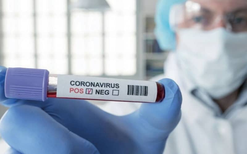 Casablanca Restricts COVID-19 Testing: Private Labs Now Limited to Travelers
