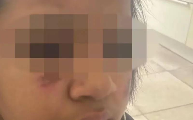 Molenbeek: Camilia, 14 years old, beaten and burned in the face by eight individuals