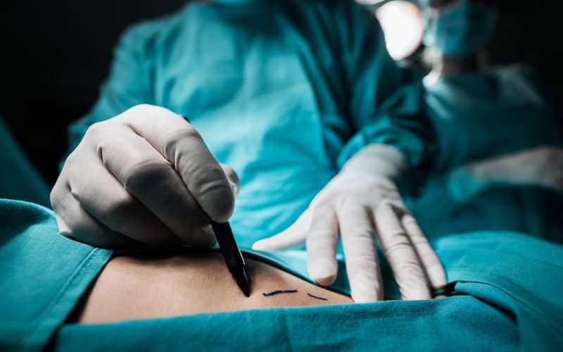 Moroccan Politicians Embrace Cosmetic Procedures to Enhance Public Image