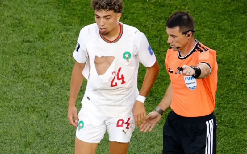 Morocco beats Scotland 1-0: Puma jersey torn in World Cup clash
