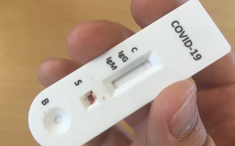 Morocco Evaluates Rapid Antigen Tests to Boost COVID-19 Detection