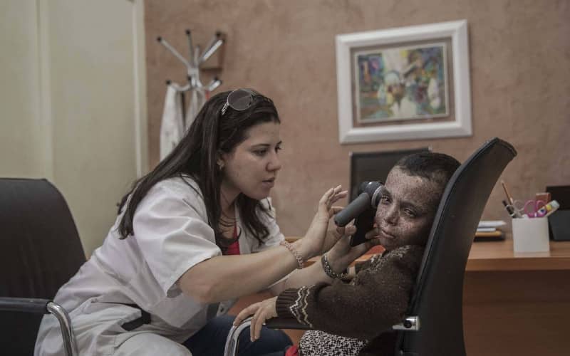 Morocco Grapples with 8,000 Rare Diseases Affecting 1.5 Million People