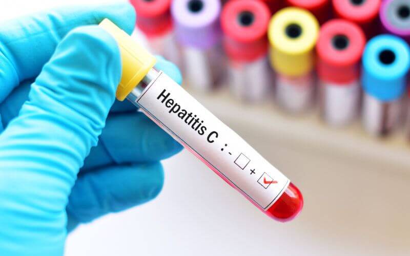 Morocco's Silent Epidemic: Viral Hepatitis Claims 10,000 Lives Annually, Affects 600,000