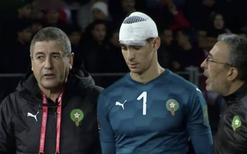 Sevilla FC's Goalkeeper Bounou in Doubt for Crucial Barcelona Clash After Head Injury