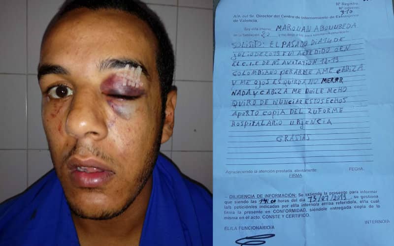 Spanish Court Clears Migrant Center in Moroccan Man's Suicide Case