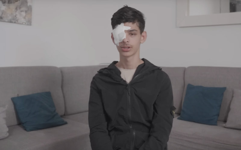 Teen Loses Eye in Police Shooting During France Protests, Family Files Complaint