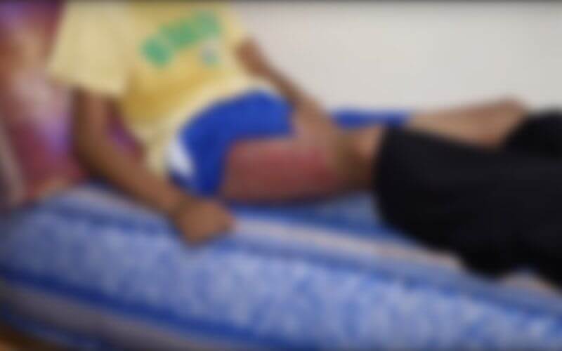 Teenager Severely Burned in Horrific Attack in Casablanca Neighborhood